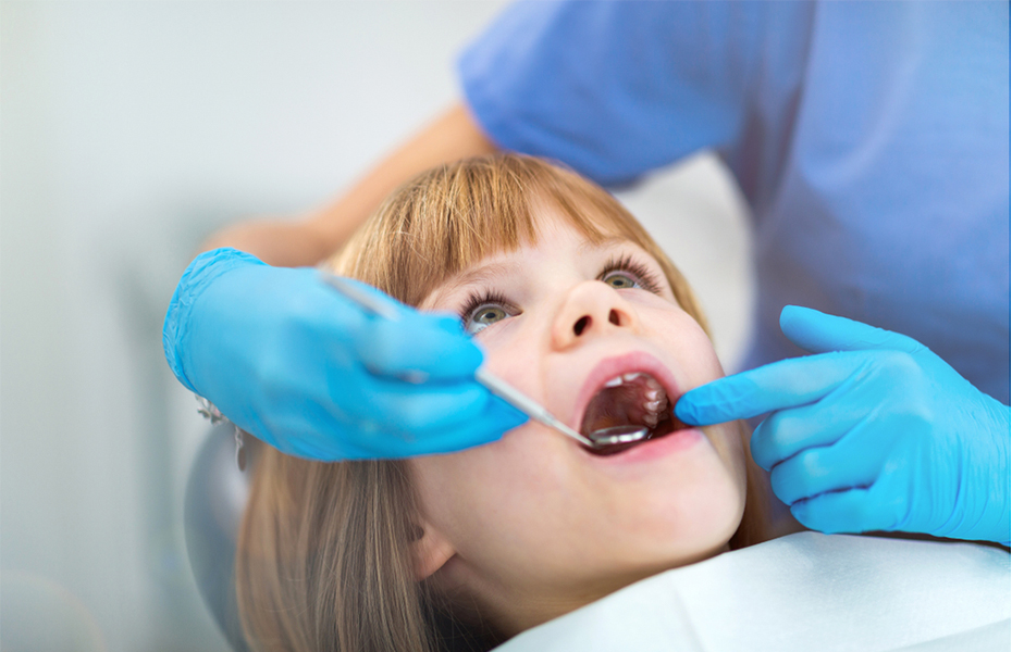 60€ από 120€ για Κάλυψη Οπών και Σχισμών (sealants) μονίμων δοντιών για παιδιά (4 δόντια) σε κορυφαίο οδοντιατρείο στη Πεύκη