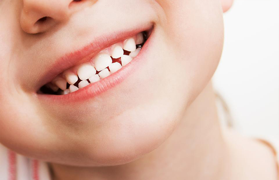 60€ από 120€ για Κάλυψη Οπών και Σχισμών (sealants) μονίμων δοντιών για παιδιά (4 δόντια) σε κορυφαίο οδοντιατρείο στη Νέα Σμύρνη